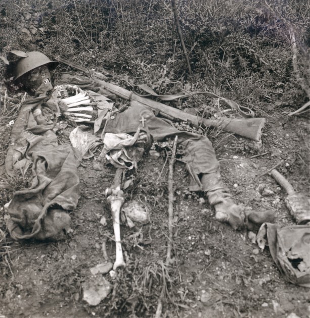 World War 1. Human wreckage in No Man's Land, Chemin des Dames, France