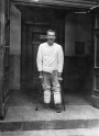 A war disabled person, who lost both of his feet in World War I