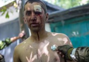 Ukraiņu gūstekņi un ievainotie - 10