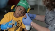 Vēsturiskā operācijā ārsti pirmoreiz pārstādījuši bērnam donora rokas - 5