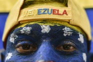 Venezuela Live Aid koncerts - 5