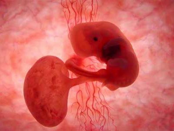 Image result for embrijs